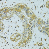 MTCH1 Rabbit Polyclonal Antibody