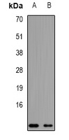 NDUFA2 Rabbit Polyclonal Antibody