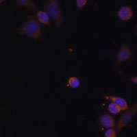 NDUFA2 Rabbit Polyclonal Antibody