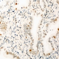 THOC1 Rabbit Polyclonal Antibody
