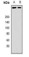ANKHD1 Rabbit Polyclonal Antibody
