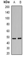 DCP2 Rabbit Polyclonal Antibody