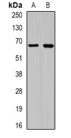 CEP57L1 Rabbit Polyclonal Antibody