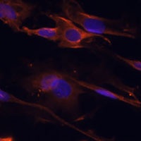 BAR Rabbit Polyclonal Antibody