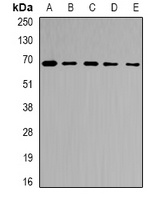 Ribophorin-2 Rabbit Polyclonal Antibody