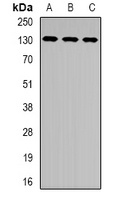 XPC Rabbit Polyclonal Antibody