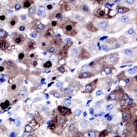 XPC Rabbit Polyclonal Antibody