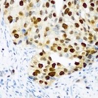 DDX39B Rabbit Polyclonal Antibody