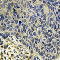 MsrB2 Rabbit Polyclonal Antibody