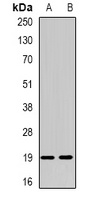 NUDT15 Rabbit Polyclonal Antibody