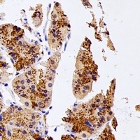 NUDT15 Rabbit Polyclonal Antibody