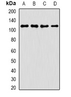 ANR52 Rabbit Polyclonal Antibody