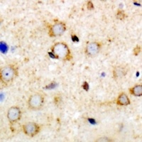 ANR52 Rabbit Polyclonal Antibody