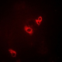 ACAD9 Rabbit Polyclonal Antibody