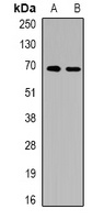 ALB Rabbit Polyclonal Antibody