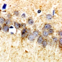 ALB Rabbit Polyclonal Antibody