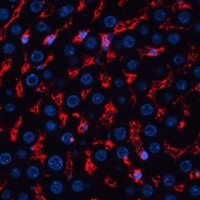 ALB Rabbit Polyclonal Antibody