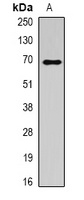 ALB Rabbit Polyclonal Antibody