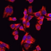 ALB Rabbit Polyclonal Antibody