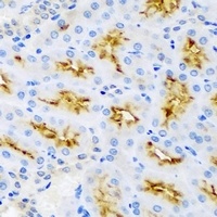 AMBRA1 Rabbit Polyclonal Antibody