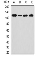 ANKRD28 Rabbit Polyclonal Antibody