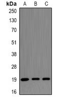 CENPS Rabbit Polyclonal Antibody