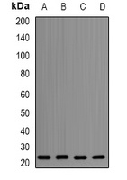 Apolipoprotein M Rabbit Polyclonal Antibody
