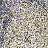 DRIL1 Rabbit Polyclonal Antibody