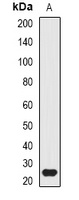 ATG10 Rabbit Polyclonal Antibody