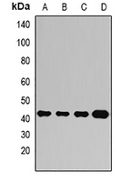 Ataxin 3 Rabbit Polyclonal Antibody