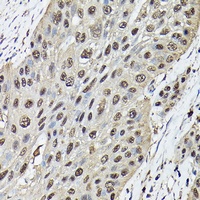 Ataxin 3 Rabbit Polyclonal Antibody
