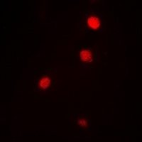 Ataxin 3 Rabbit Polyclonal Antibody