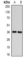 BCLG Rabbit Polyclonal Antibody