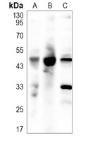 BMP15 Rabbit Polyclonal Antibody