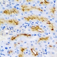 BMP15 Rabbit Polyclonal Antibody
