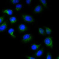BMP15 Rabbit Polyclonal Antibody