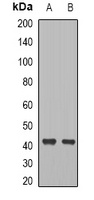 CCR8 Rabbit Polyclonal Antibody