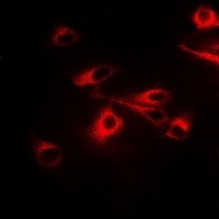 CCT2 Rabbit Polyclonal Antibody