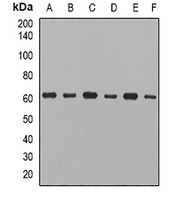 CCT3 Rabbit Polyclonal Antibody