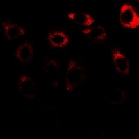CCT3 Rabbit Polyclonal Antibody