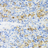 CD27 Rabbit Polyclonal Antibody