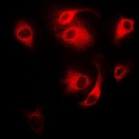 CD27 Rabbit Polyclonal Antibody