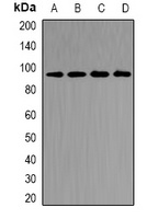 CD2AP Rabbit Polyclonal Antibody