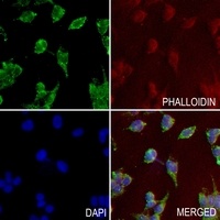 CD36 Rabbit Polyclonal Antibody