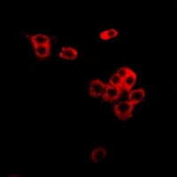 CD86 Rabbit Polyclonal Antibody