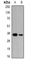 CDK6 Rabbit Polyclonal Antibody