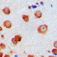 CDK6 Rabbit Polyclonal Antibody