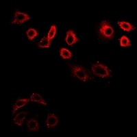 CDK6 Rabbit Polyclonal Antibody