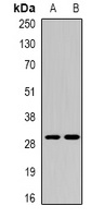 CEACAM7 Rabbit Polyclonal Antibody