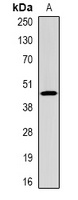 CFHR1 Rabbit Polyclonal Antibody